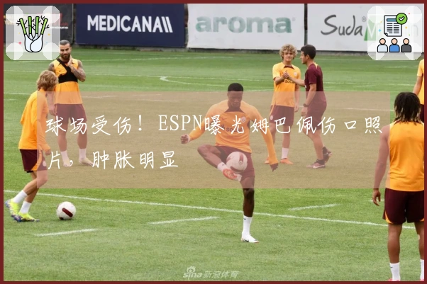 球场受伤！ESPN曝光姆巴佩伤口照片，肿胀明显
